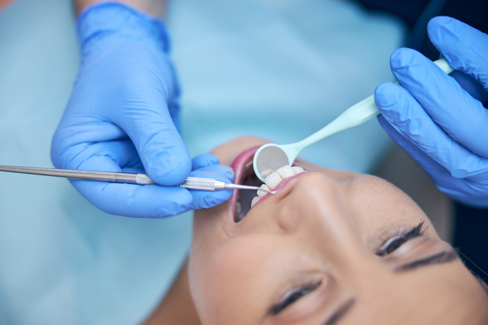 Periodontoloji (Diş Eti Tedavisi)